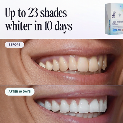Teeth Whitening U-Wraps